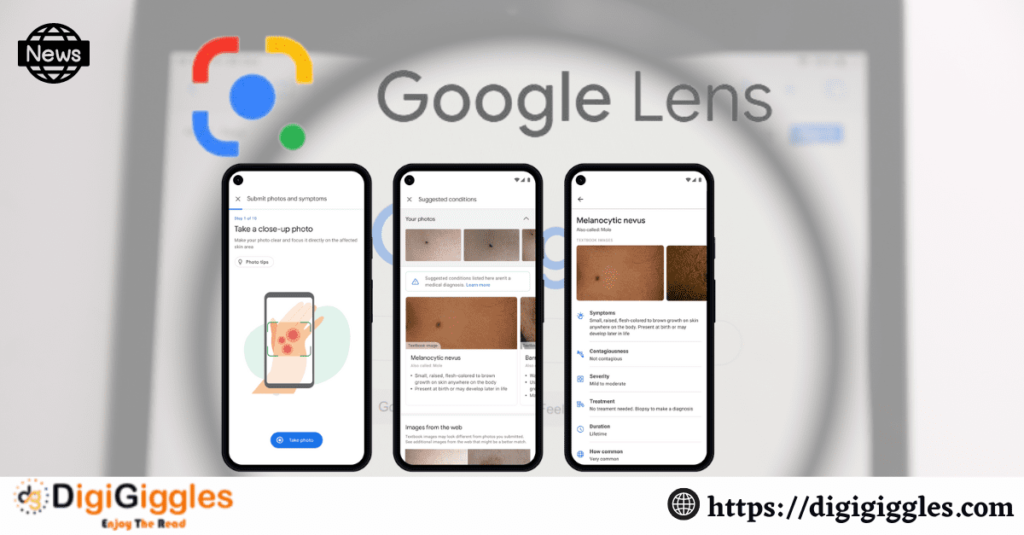 Identify your Skin with Google Lens’s new feature