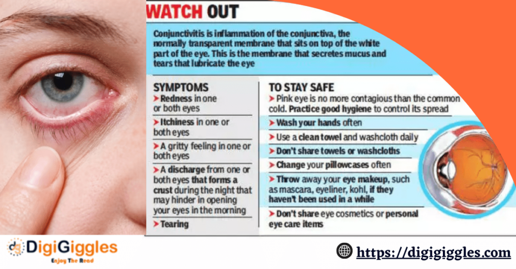 Conjunctivitis Cases on a Rise During Monsoon Season: Tips for Preventing Pink Eye